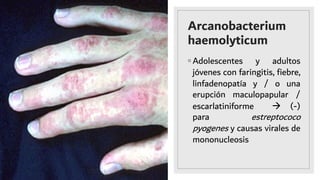 Arcanobacterium
haemolyticum
◦ Adolescentes y adultos
jóvenes con faringitis, ﬁebre,
linfadenopatía y / o una
erupción maculopapular /
escarlatiniforme à (-)
para estreptococo
pyogenes y causas virales de
mononucleosis
 