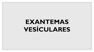 EXANTEMAS
VESÍCULARES
 