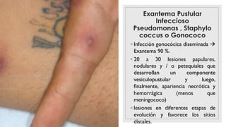 Exantema Pustular
Infeccioso
Pseudomonas , Staphylo
coccus o Gonococo
◦ Infección gonocócica diseminada à
Exantema 90 %.
◦ 20 a 30 lesiones papulares,
nodulares y / o petequiales que
desarrollan un componente
vesiculopustular y luego,
finalmente, apariencia necrótica y
hemorrágica (menos que
meningococo)
◦ lesiones en diferentes etapas de
evolución y favorece los sitios
distales.
 