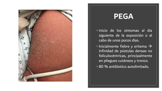 PEGA
◦ inicio de los síntomas al día
siguiente de la exposición o al
cabo de unos pocos días.
◦ Inicialmente ﬁebre y eritema à
inﬁnidad de pústulas densas no
foliculocéntricas, principalmente
en pliegues cutáneos y tronco.
◦ 80 % antibiotico autolimitado.
 