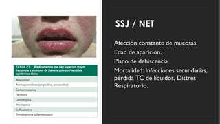 SSJ / NET
◦ Afección constante de mucosas.
◦ Edad de aparición.
◦ Plano de dehiscencia
◦ Mortalidad: Infecciones secundarias,
pérdida TC de líquidos, Distrés
Respiratorio.
 