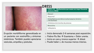 DRESS
Erupción morbiliforme generalizada en
un paciente con eosinoﬁlia y síntomas
sistémicos. También pueden apreciarse
vesículas, ampollas y pústulas.
o Inicio demorado 2-6 semanas post exposición.
o Fiebre-Flu like à Exantema + Dolor urente.
o Inicio en cara y tronco superior à distal.
o Puede haber c. de mucosa menos intenso.
 
