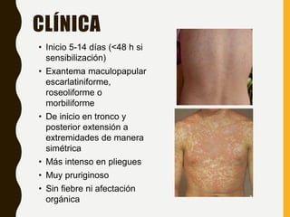 Exantema medicamentoso sesion | PPT