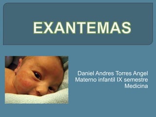 Daniel Andres Torres Angel
Materno infantil IX semestre
                    Medicina
 