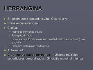 HERPANGINA
►   Erupción bucal causada x virus Coxackie A
►   Prevalencia estacional
►   Clínica:
     Fiebre de comienzo agudo
     Faringitis, disfagia
     Lesiones papulovesiculosas en cavidad oral posterior (sem), sin
      gingivitis
     Síntomas sistémicos moderados
►   Autolimitado
►   Gingivoestomatitis herpética → Ulceras múltiples
    superficiales generalizadas. Gingivitis marginal intensa.
 