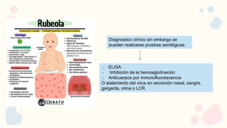 Diagnostico clínico sin embargo se
pueden realizarse pruebas serológicas
- ELISA
- Inhibición de la hemoaglutinación
- Anticuerpos por inmunofluorescencia
O aislamiento del virus en secreción nasal, sangre,
garganta, orina o LCR.
 