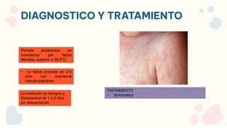DIAGNOSTICO Y TRATAMIENTO
• La fiebre precede en 2-4
días con exantema
máculo-papuloso
Periodo prodrómico se
caracteriza por fiebre
elevada, superior a 38,5°C.
Le evolución es benigna y
Desaparece de 1 a 2 días
sin descamación.
TRATAMIENTO
• Sintomático
 