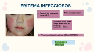 ERITEMA INFECCIOSOS
Definición y
etiologia
• Causada por parvovirus
humano B19
Niños en edad escolar
Contagioso 5 días antes
y hasta la aparición del
exantema.
Incubación 4-28 días
• Primera manifestación clínica: MEGALOERITEMA
 