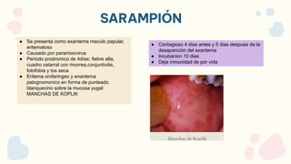 SARAMPIÓN
● Se presenta como exantema maculo papular,
eritematoso
● Causado por paramixovirus
● Periodo prodromico de 4días: fiebre alta,
cuadro catarral con rinorrea,conjuntivitis,
fotofobia y tos seca
● Eritema orofaringeo y enantema
patognomonico en forma de punteado
blanquecino sobre la mucosa yugal:
MANCHAS DE KOPLIK
● Contagioso 4 dias antes y 5 dias despues de la
desaparición del exantema
● Incubacion 10 dias
● Deja inmunidad de por vida
 