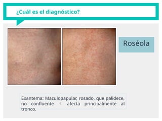 Exantemas de la infancia pediatria pedia | PPTX