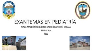 EXANTEMAS EN PEDIATRÍA
AYALA MALDONADO JORGE YADIR BRANDOM OSMAN
PEDIATRIA
2022
 