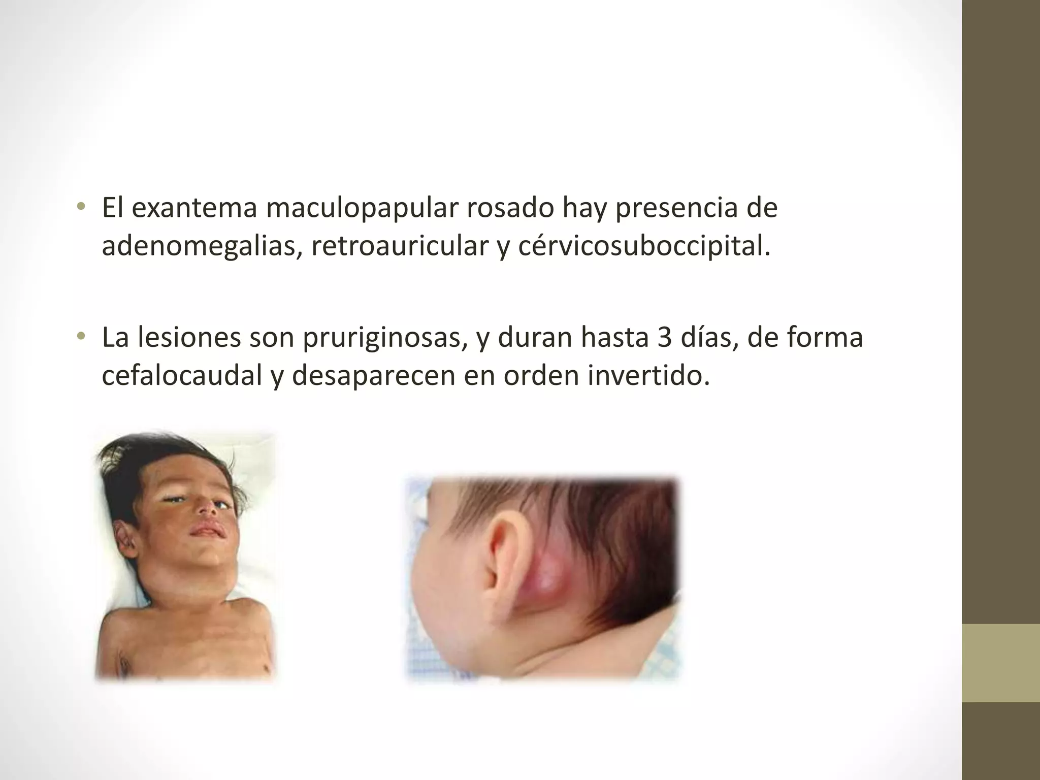 Exantemas maculo papulares | PPTX