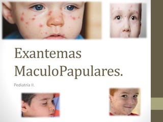 Exantemas
MaculoPapulares.
Pediatría II.
 