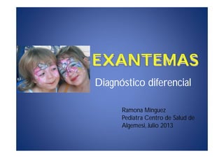 EXANTEMAS
Diagnóstico diferencial
Ramona Mínguez
Pediatra Centro de Salud de
Algemesi, Julio 2013
 