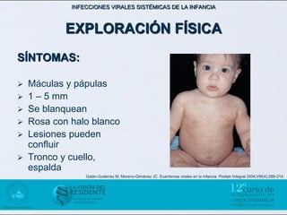 INFECCIONES VIRALES SISTÉMICAS DE LA INFANCIA



            EXPLORACIÓN FÍSICA
SÍNTOMAS:

   Máculas y pápulas
   1 – 5 mm
   Se blanquean
   Rosa con halo blanco
   Lesiones pueden
    confluir
   Tronco y cuello,
    espalda
                 Galán-Gutiérrez M, Moreno-Giménez JC. Exantemas virales en la infancia. Pediatr Integral 2004;VIII(4):289-314.
 