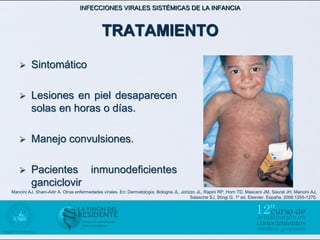INFECCIONES VIRALES SISTÉMICAS DE LA INFANCIA



                                            TRATAMIENTO

        Sintomático

        Lesiones en piel desaparecen
         solas en horas o días.

        Manejo convulsiones.

        Pacientes inmunodeficientes
         ganciclovir
Mancini AJ, Shani-Adir A. Otras enfermedades vírales. En: Dermatología. Bologna JL, Jorizzo JL, Rapini RP, Horn TD, Mascaro JM, Saurat JH, Mancini AJ,
                                                                                         Salasche SJ, Stingi G. 1º ed. Elsevier. España, 2006:1255-1270.
 