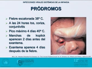 INFECCIONES VIRALES SISTÉMICAS DE LA INFANCIA



                                     PRÓDROMOS

   Fiebre escalonada 38º C.
   A las 24 horas tos, coriza,
    conjuntivitis
   Pico máximo 4 días 40º C.
   Manchas       de    koplick
    aparecen 2 días antes del
    exantema.
   Exantema aparece 4 días
    después de la fiebre.
      BELL LM, Measles (Rubeolla-First Disease) En “The 5 minute PediatricConsult” M. W. Schwartz. Ed. Williams and Wilkins. Baltimore 2007
 