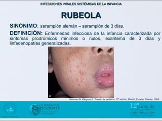 INFECCIONES VIRALES SISTÉMICAS DE LA INFANCIA



                        RUBEOLA
SINÓNIMO: sarampión alemán – sarampión de 3 días.
DEFINICIÓN: Enfermedad infecciosa de la infancia caracterizada por
síntomas prodrómicos mínimos o nulos, exantema de 3 días y
linfadenopatías generalizadas.




                             Behrman N, Kliegman 1. Tratado de pediatría. 17" edición. Madrid, España: Elsevier; 2008..
 