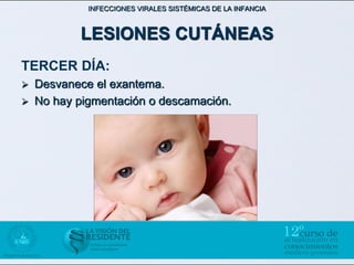 INFECCIONES VIRALES SISTÉMICAS DE LA INFANCIA



           LESIONES CUTÁNEAS
TERCER DÍA:
   Desvanece el exantema.
   No hay pigmentación o descamación.
 