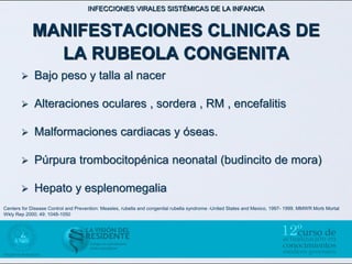 INFECCIONES VIRALES SISTÉMICAS DE LA INFANCIA


            MANIFESTACIONES CLINICAS DE
              LA RUBEOLA CONGENITA
            Bajo peso y talla al nacer

            Alteraciones oculares , sordera , RM , encefalitis

            Malformaciones cardiacas y óseas.

            Púrpura trombocitopénica neonatal (budincito de mora)

            Hepato y esplenomegalia
Centers for Disease Control and Prevention: Measles, rubella and congenital rubella syndrome -United States and Mexico, 1997- 1999. MMWR Morb Mortal
Wkly Rep 2000; 49: 1048-1050
 