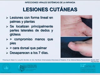 INFECCIONES VIRALES SISTÉMICAS DE LA INFANCIA



                               LESIONES CUTÁNEAS
          Lesiones con forma lineal en
           palmas y plantas
          Se localizan principalmente
           partes laterales de dedos y
           glúteos
          > compromiso manos que
           pies
          > cara dorsal que palmar
          Desaparecen a los 7 días.
Pickering LK, Baker CJ, Long SS, Mcmillan JA, Dirs. Red Book: Enfermedades Infecciosas en Pediatría. 27 ed. Editorial Medica Panamericana: Madrid; 2007
                                                                                                                                           Pag 642-644
 