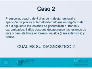Caso 2
Preescolar, cuadro de 4 días de malestar general y
aparición de placas eritematoedematosas en región malar
al día siguiente las lesiones se generalizan a tronco y
extremidades, 3 días después desaparecen las lesiones de
cara y persiste brote en brazos, muslos (cara extensora) y
tronco.


        CUAL ES SU DIAGNOSTICO ?
 