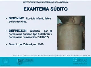INFECCIONES VIRALES SISTÉMICAS DE LA INFANCIA



                         EXANTEMA SÚBITO
   SINÓNIMO: Roséola infantil, fiebre
    de los tres días.


   DEFINICIÓN: Infección        por el
    herpesvirus humano tipo 6 (HHV-6) y
    herpesvirus humano tipo 7 (HHV-7).

   Descrito por Zahorsky en 1910



        Weston W, Lane A. Infecciones Víricas. En: Manual en Color de Dermatología Pediátrica. 1º ed. Mosby Year Book. Londres, 2002:76-101.
 