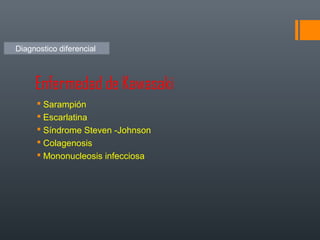 Enfermedad de Kawasaki
 Sarampión
 Escarlatina
 Síndrome Steven -Johnson
 Colagenosis
 Mononucleosis infecciosa
Diagnostico diferencial
 