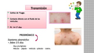 Enfermedades exantematicas en los niños | PPTX