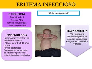 ERITEMA INFECCIOSO
“Quinta enfermedad”
ETIOLOGIA
Parvovirus B19
Virus de ADN
Familia: Parvoviridae
Genero: Erythrovirus
EPIDEMIOLOGIA
•Infecciones frecuentes y de
distribucion mundial
•70% se da entre 5-15 años
de edad
•Brotes epidemicos
frecuentes en las escuelas
de educacion primaria y
entre trabajadores sanitarios
TRANSMISION
•Via respiratoria
•Difusion de gotitas de
secrecion nasofaringea
•Sangre-Hemoderivados
•Fomites
 