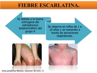 Es debida a la toxina
eritrogena del
estreptococo
betahemolitico del
grupo A
Se observa en niños de 1 a
10 años y se transmite a
través de secreciones
respiratorias.
FIEBRE ESCARLATINA.
Acta pediátrica México, volumen 36 núm.: 5
 