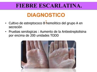 • Cultivo de estreptococo B hemolitico del grupo A en
secreción
• Pruebas serologicas : Aumento de la Antiestreptolisina
por encima de 200 unidades TODD
FIEBRE ESCARLATINA.
DIAGNOSTICO
:
 