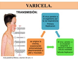 El virus penetra a
el organismo por
la via respiratroria
Primera
Replicacion
El virus penetra a
la circulación
sanguínea y
alcanza el sistema
reticulo endotelial
Sefunda Replicacion
se origina la
viremia,
ocasionando
sintomatologia
diseminandose a
piel y mucosas .
Acta pediátrica México, volumen 36 núm.: 5
VARICELA.
TRANSMISIÓN:
 
