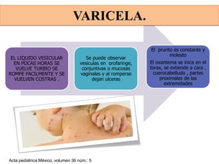 EL LIQUIDO VESICULAR
EN POCAS HORAS SE
VUELVE TURBIO SE
ROMPE FACILMENTE Y SE
VUELVEN COSTRAS .
El prurito es constante y
molesto
El exantema se inica en el
torax, se extiende a cara ,
cuerocabelludo , partes
proximales de las
extremidades
Se puede observar
vesiculas en orofaringe,
conjuntivas o mucosas
vaginales y al romperse
dejan ulceras
Acta pediátrica México, volumen 36 núm.: 5
VARICELA.
 