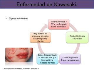 • Signos y síntomas
Enfermedad de Kawasaki.
Fiebre abrupta ˃
39°c prolongada
hasta 4 semanas
Conjuntivitis sin
secrecion
Labios rojos con
fisuras y costrosos.
Existe hiperemia de
la mucosa oral y la
lengua tiene
aspecto de fresa
Hay edema en
manos y pies con
eritema palmo
plantar
Acta pediátrica México, volumen 36 núm.: 5
 