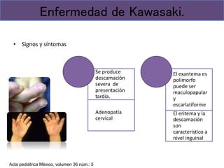 • Signos y síntomas
Enfermedad de Kawasaki.
Se produce
descamación
severa de
presentación
tardía.
Adenopatía
cervical
El exantema es
polimorfo
puede ser
maculopapular
y
escarlatiforme
El eritema y la
descamación
son
característico a
nivel inguinal
Acta pediátrica México, volumen 36 núm.: 5
 