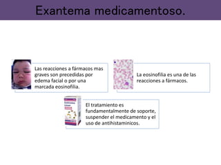 Las reacciones a fármacos mas
graves son precedidas por
edema facial o por una
marcada eosinofilia.
La eosinofilia es una de las
reacciones a fármacos.
El tratamiento es
fundamentalmente de soporte,
suspender el medicamento y el
uso de antihistaminicos.
Exantema medicamentoso.
 