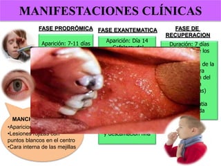MANIFESTACIONES CLÍNICAS
•Aparicion: 1-4 dias
•Lesiones rojizas con
puntos blancos en el centro
•Cara interna de las mejillas
MANCHAS DE KOPLIK
Aparición: 7-11 días
•Fiebre
•Conjuntivitis
•Fotofobia
•Coriza
•Tos intensa
•Enantema
“Manchas de Koplik”
Aparición: Día 14
•Cefalocaudal
•Cara-Tronco-
Extremidades
•Palmas y plantas
(50%)
•Tipo: Morbiliforme
(Maculopapular
eritematoso)
•Duración: 7 días
•Desvanece en
mismo orden de
aparición
•Manchas color café
y descamación fina
Duración: 7 días
•Remisión de los
síntomas
•Normalización de la
temperatura
•Desaparición del
exantema
•Tos (10 días)
•Grave:
Linfadenopatia
generalizada
FASE PRODRÓMICA FASE EXANTEMATICA FASE DE
RECUPERACION
 