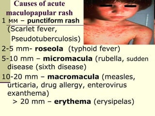Exanthema_presentation infectionsdiseases.ppt