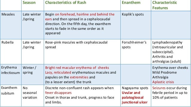 Measles - KidsHealth