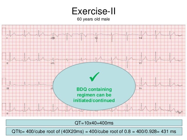 Excercise corrected qt interval (q tc) ecg interpretation