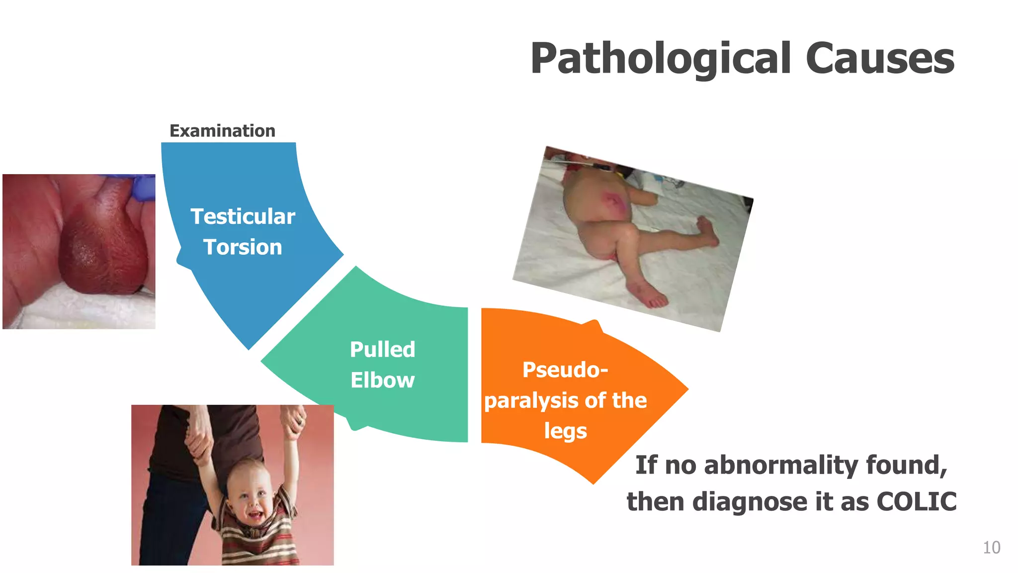 10
If no abnormality found,
then diagnose it as COLIC
Pseudo-
paralysis of the
legs
Pulled
Elbow
Testicular
Torsion
Pathological Causes
Examination