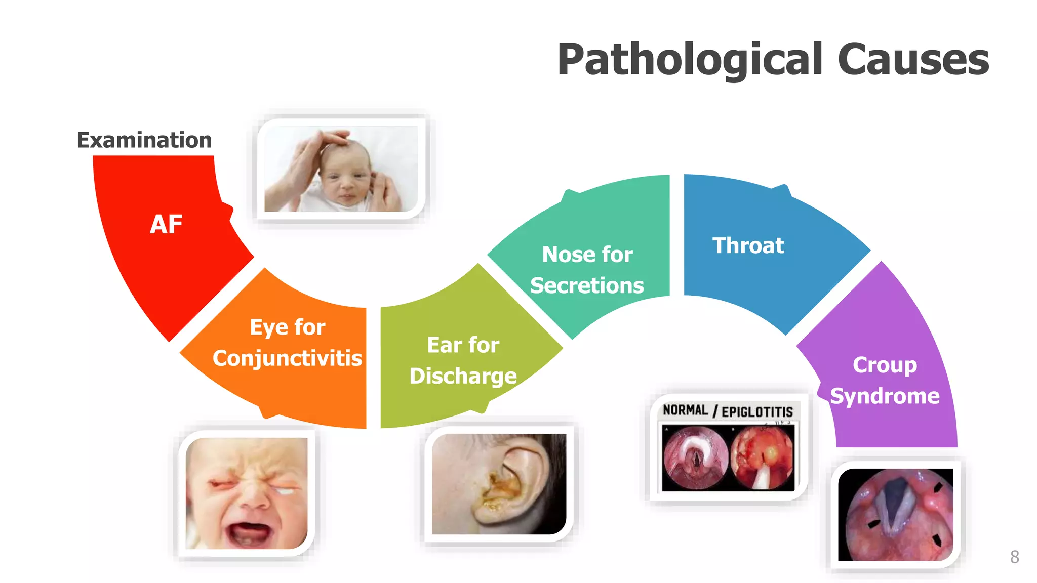 8
AF
Eye for
Conjunctivitis
Ear for
Discharge
Nose for
Secretions
Throat
Croup
Syndrome
Pathological Causes
Examination