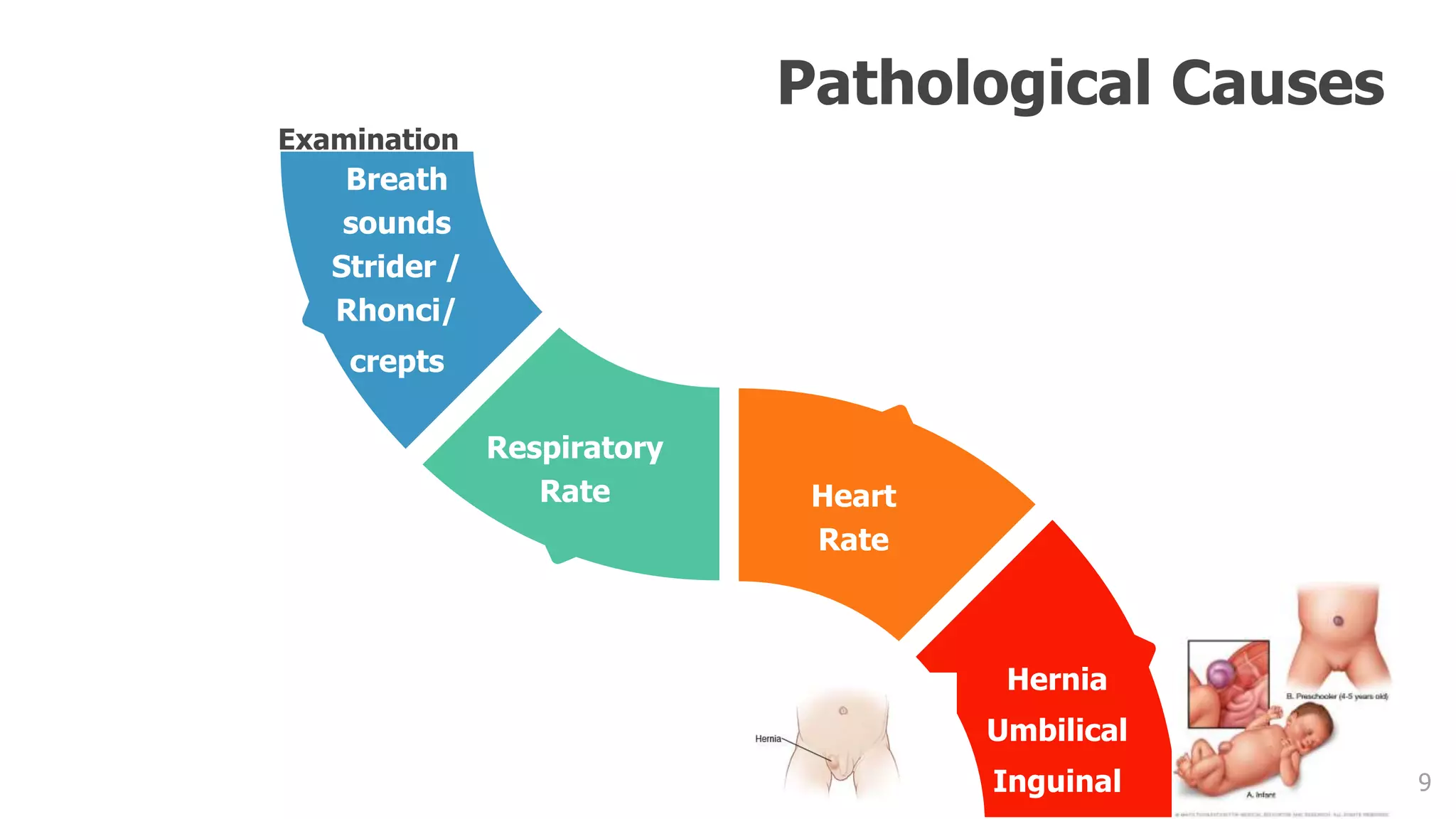 9
Hernia
Umbilical
Inguinal
Heart
Rate
Respiratory
Rate
Breath
sounds
Strider /
Rhonci/
crepts
Pathological Causes
Examination