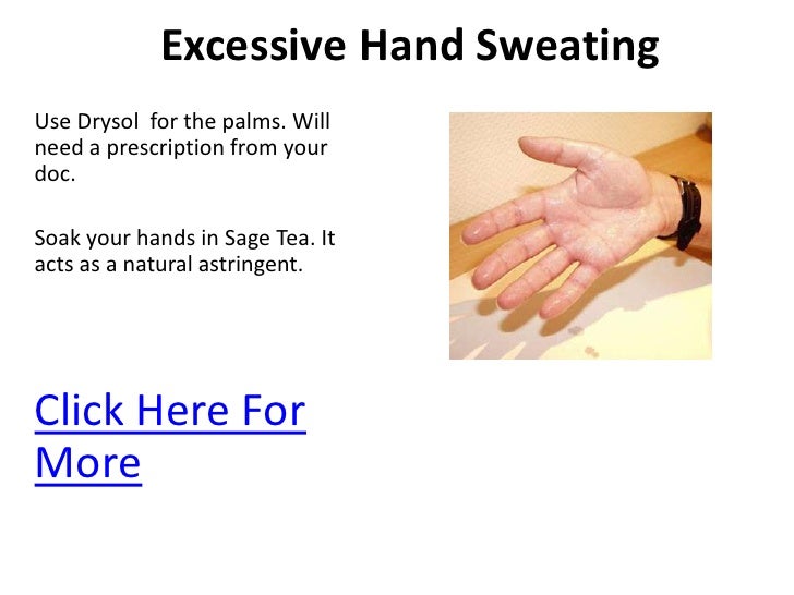 Excessive hand sweating