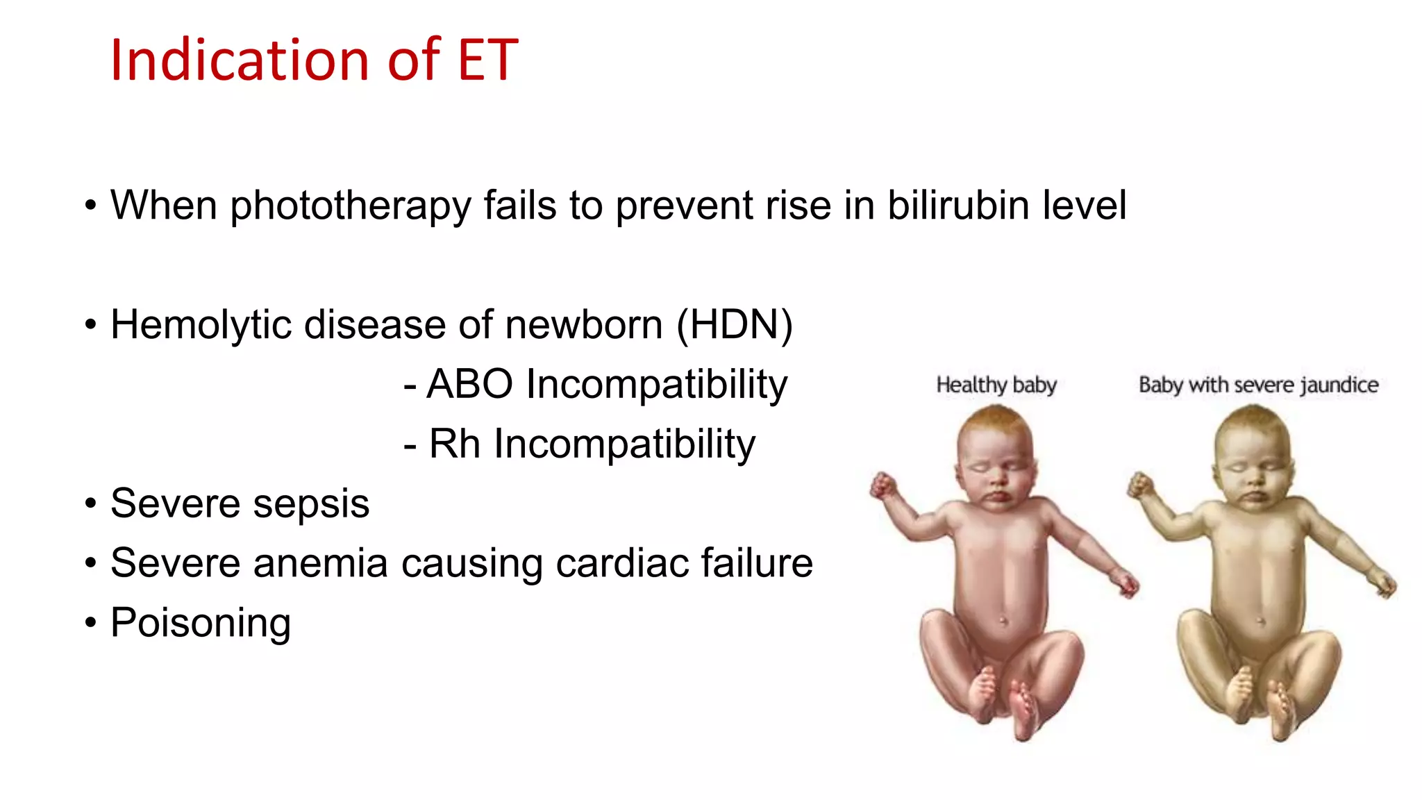 Indication of ET
• When phototherapy fails to prevent rise in bilirubin level
• Hemolytic disease of newborn (HDN)
- ABO Incompatibility
- Rh Incompatibility
• Severe sepsis
• Severe anemia causing cardiac failure
• Poisoning
 