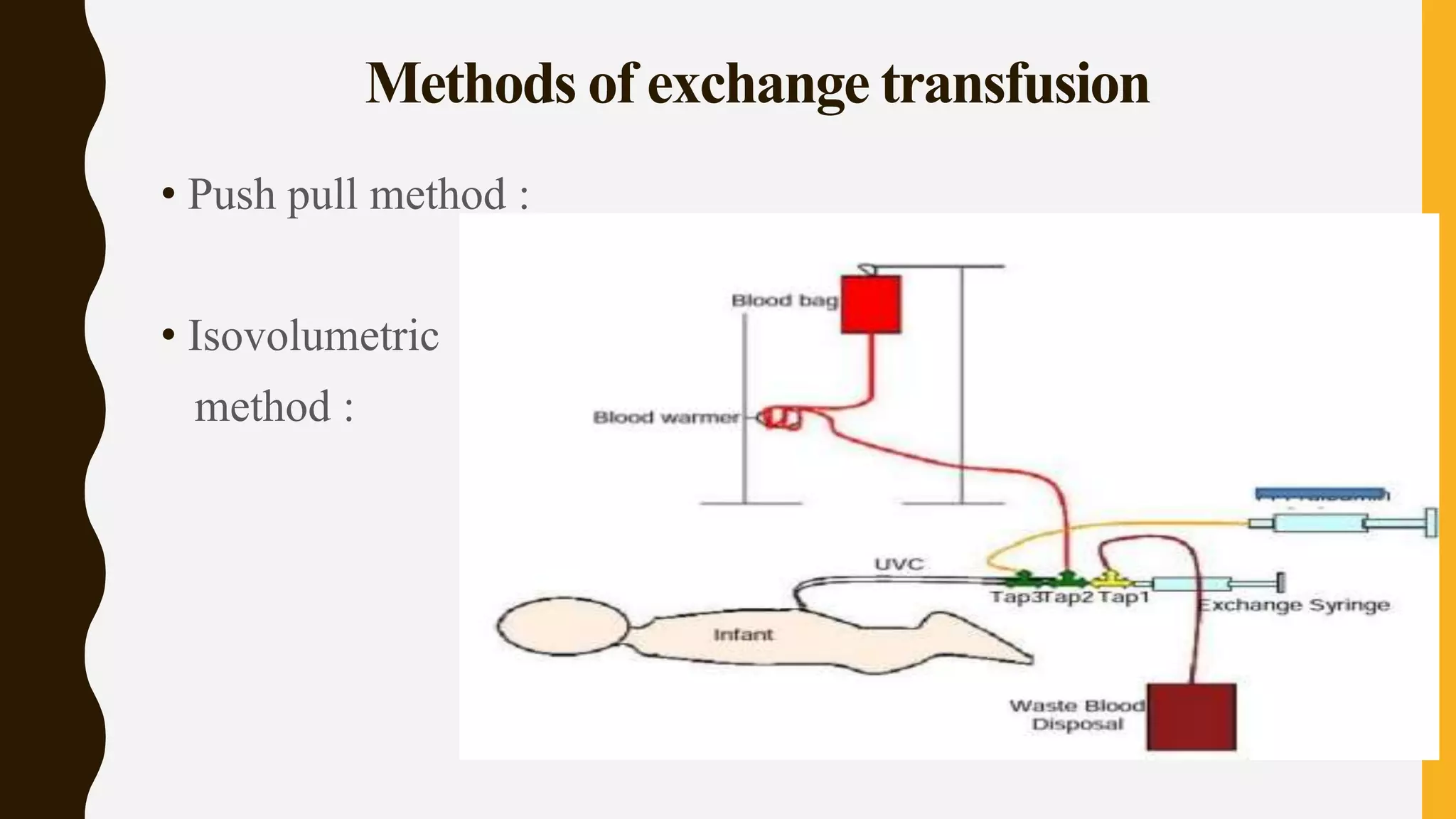 Methods of exchange transfusion
• Push pull method :
• Isovolumetric
method :
 