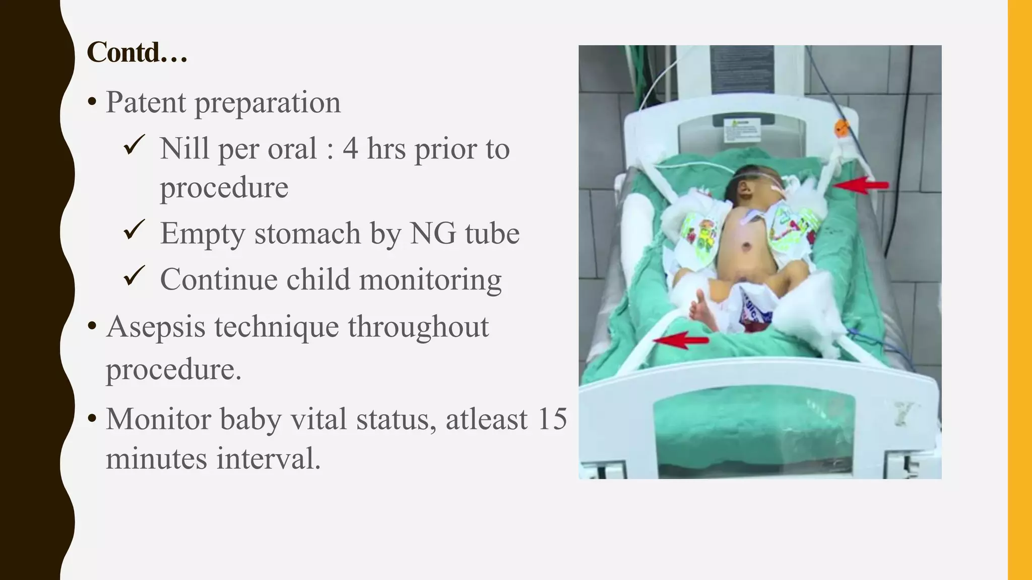 Contd…
• Patent preparation
 Nill per oral : 4 hrs prior to
procedure
 Empty stomach by NG tube
 Continue child monitoring
• Asepsis technique throughout
procedure.
• Monitor baby vital status, atleast 15
minutes interval.
 