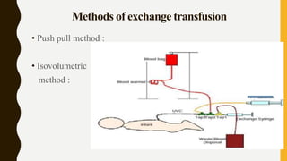 Methods of exchange transfusion
• Push pull method :
• Isovolumetric
method :
 