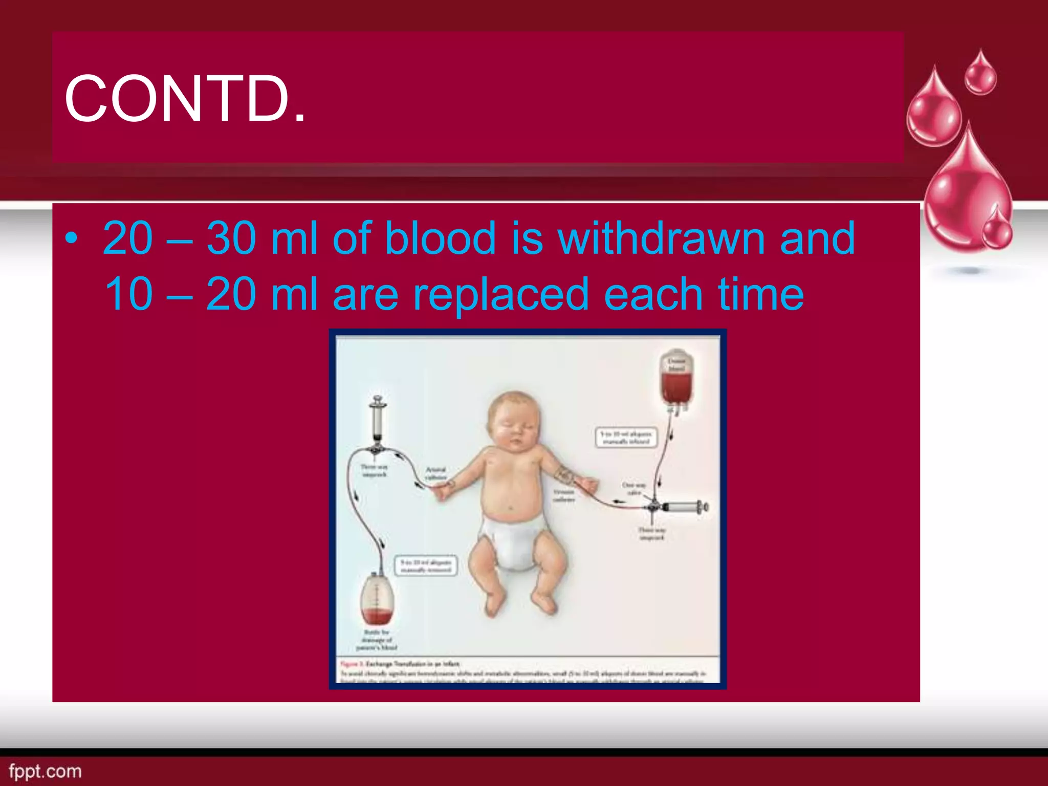CONTD.
• 20 – 30 ml of blood is withdrawn and
10 – 20 ml are replaced each time
 